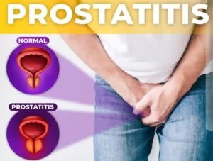Prostasis