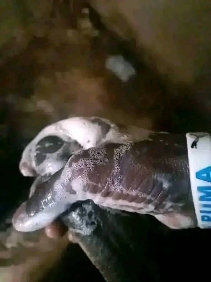 MADHARA YA PUNYETO.....DR MBILINYI 